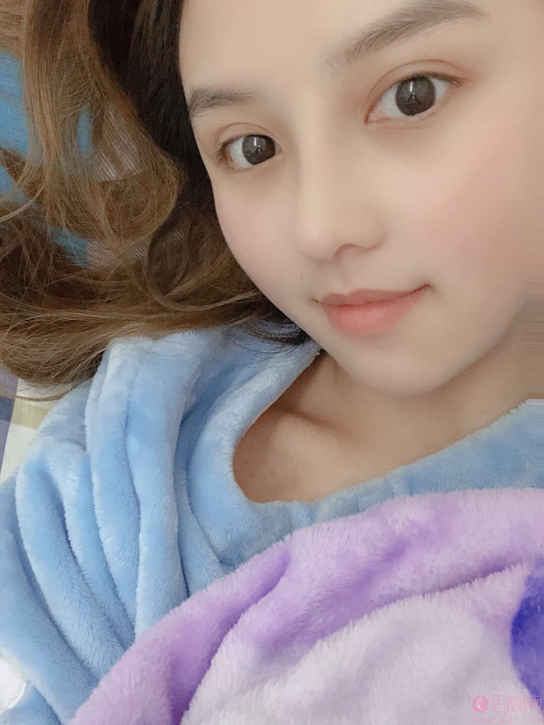 成都美极整形王伟鼻整形案例展示，附价格表查询