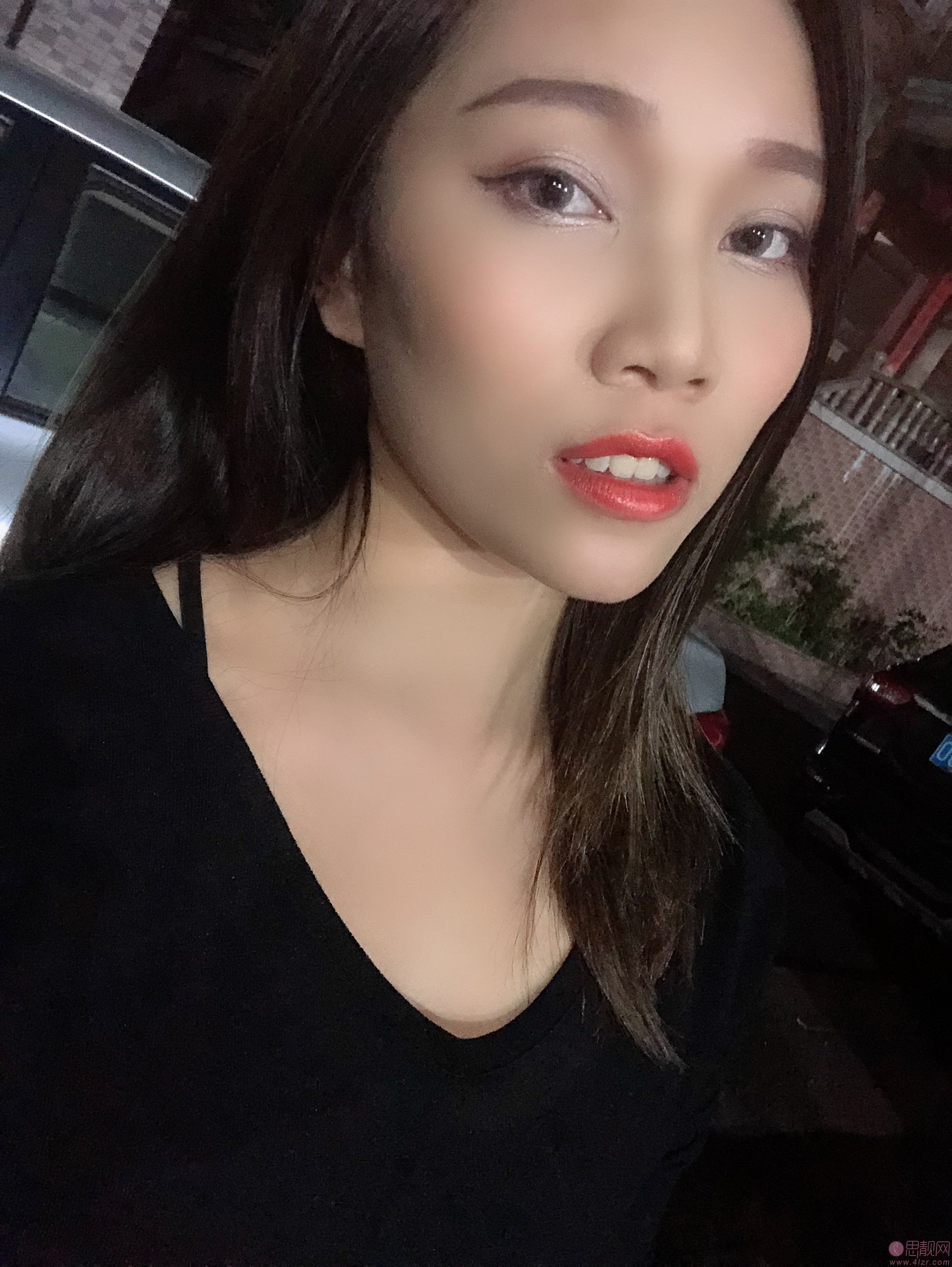 北京圣贝口腔价格表及案例效果一览