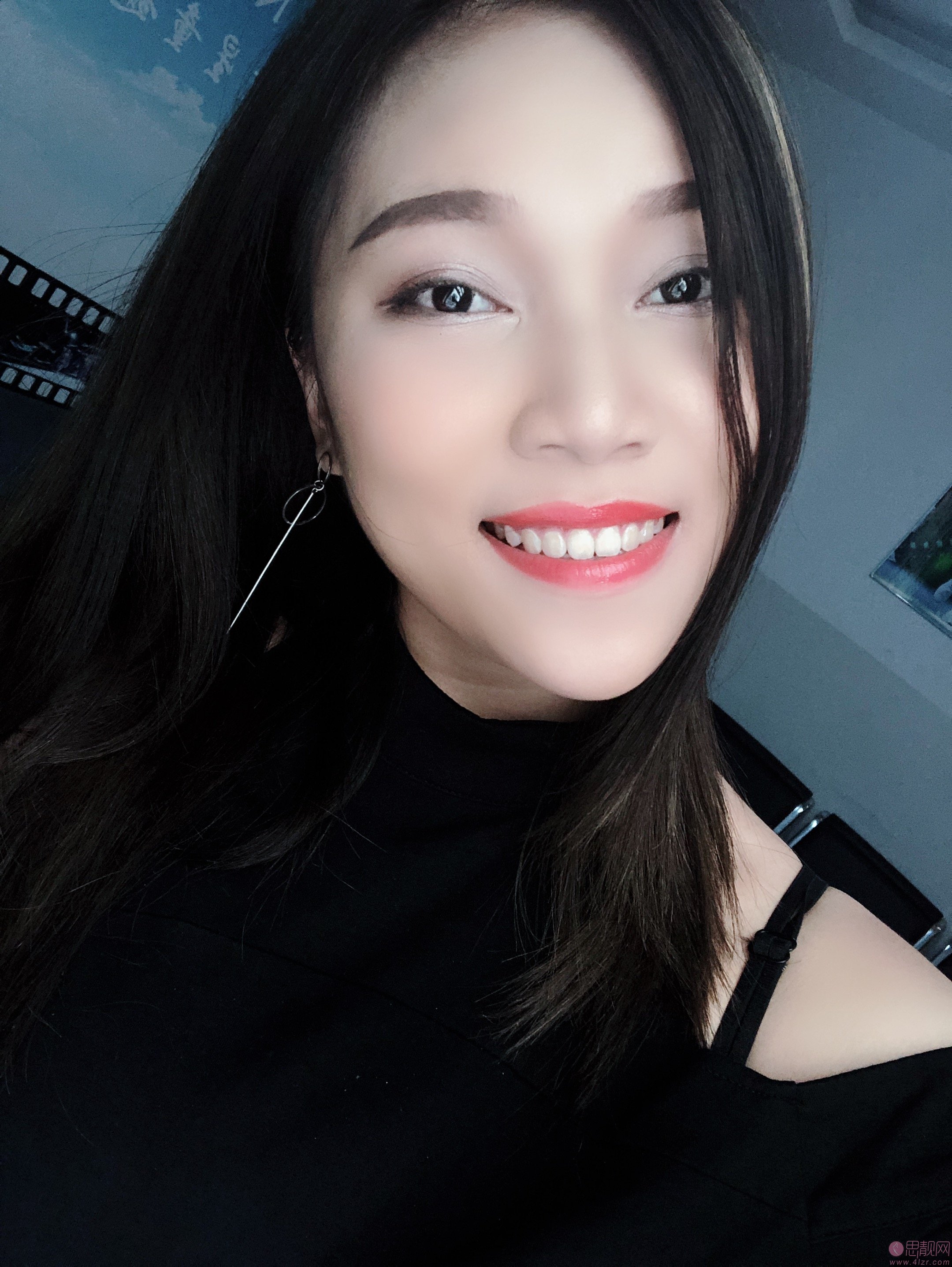 北京圣贝口腔价格表及案例效果一览