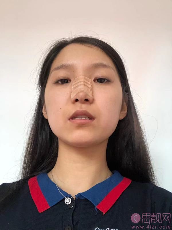 吉林大学中日联谊医院整形价格表