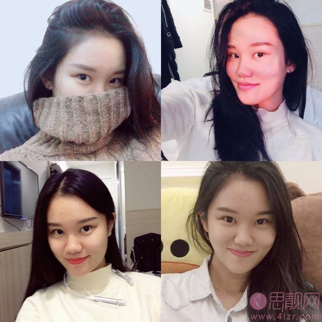 南方医科大学深圳医院整形美容科怎么样，2020价格表一览