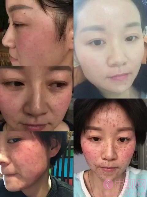 南方医科大学深圳医院整形美容科怎么样，2020价格表一览