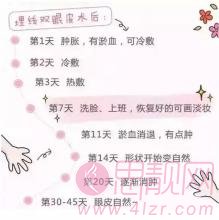 埋线双眼皮可以拆吗?