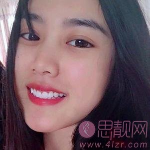 广州市欧顿口腔门诊部好不好?2020价格表+美白牙齿案例