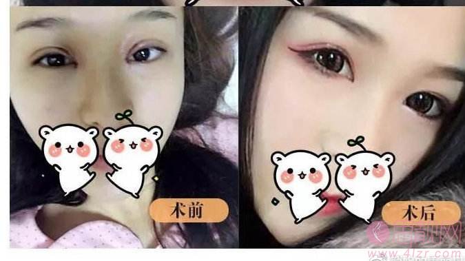 首都医科大学附属北京友谊医院整形怎么样？2020价格表一览+医生简介