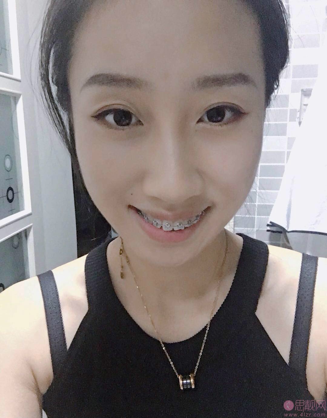 拜博口腔医院（广州协贤店）怎么样？附2020价格表+牙齿矫正案例一览