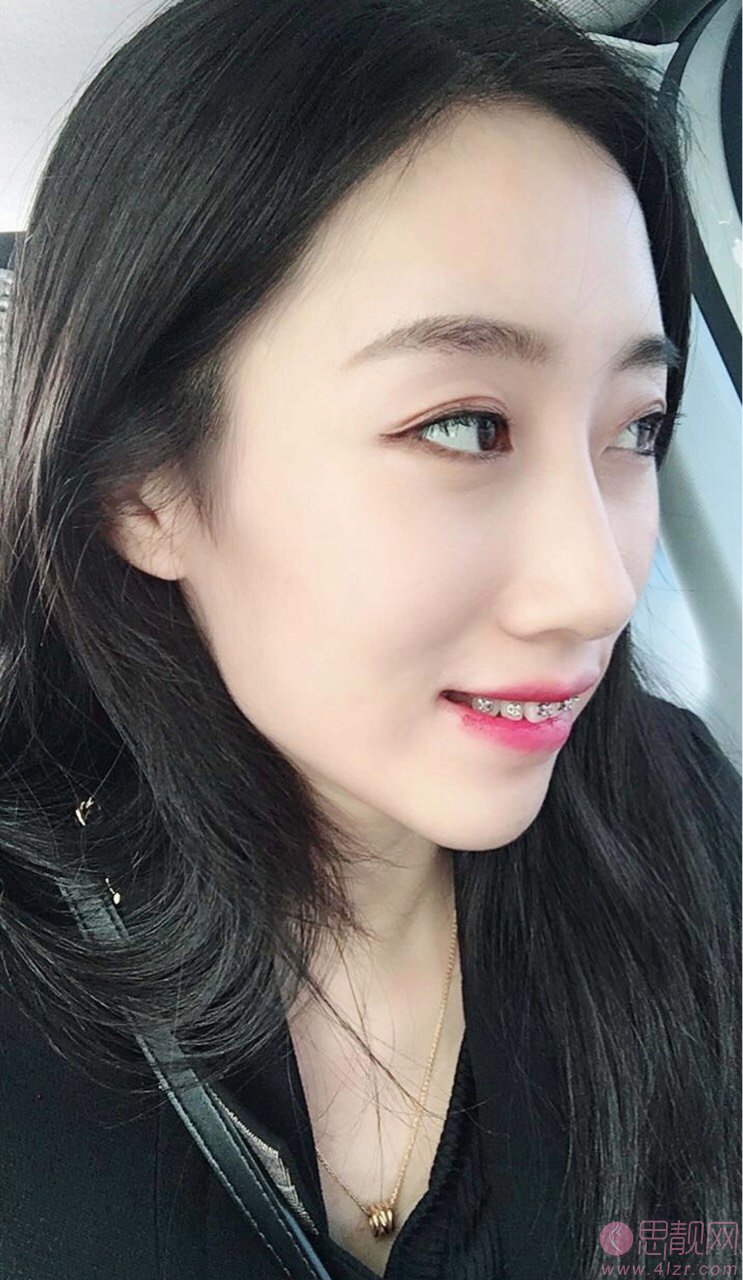 拜博口腔医院（广州协贤店）怎么样？附2020价格表+牙齿矫正案例一览