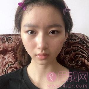滨州医学院附属医院整形美容怎么样？2020价格表一览