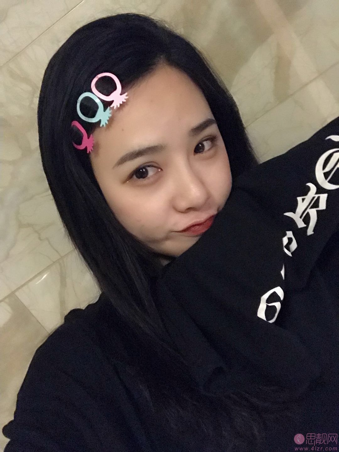 重庆康雅医疗美容诊所隆鼻怎么样？2020价格表出炉