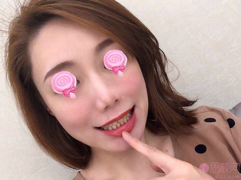 上海爱莫儿整形医院口腔科怎么样?2020价位表