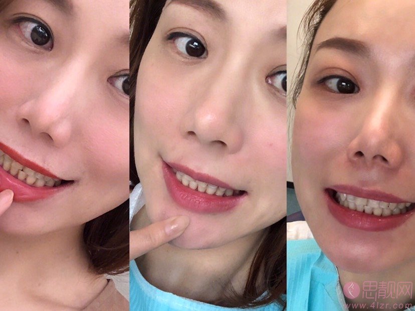 上海爱莫儿整形医院口腔科怎么样?2020价位表
