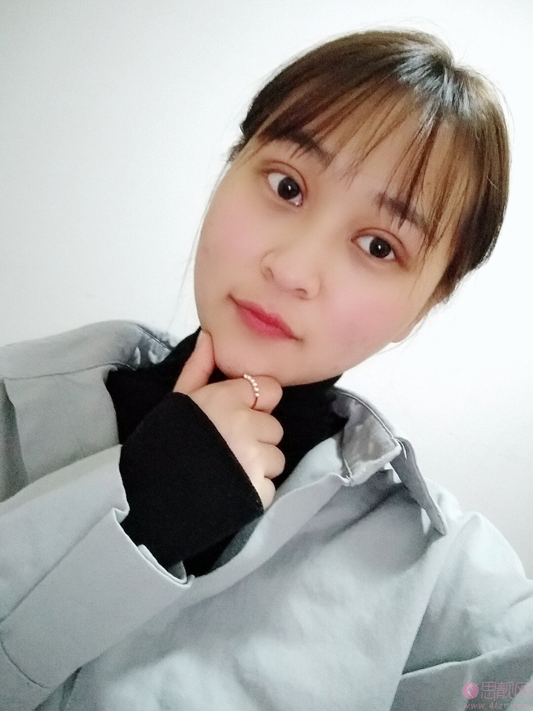 阜阳黛莱美整形李进超做双眼皮怎么样？2020价格表出炉+双眼皮案例一览