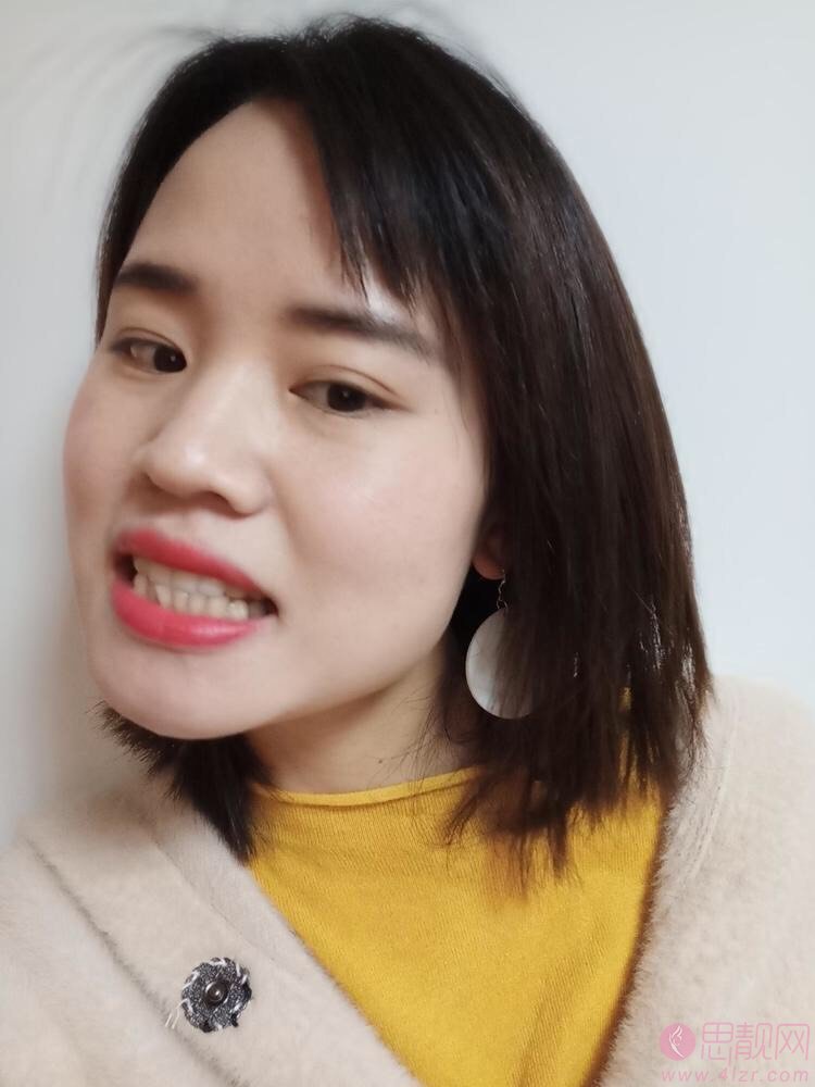 武汉仁爱医院口腔科怎么样?2020价格表曝光+超声波洗牙案例展示
