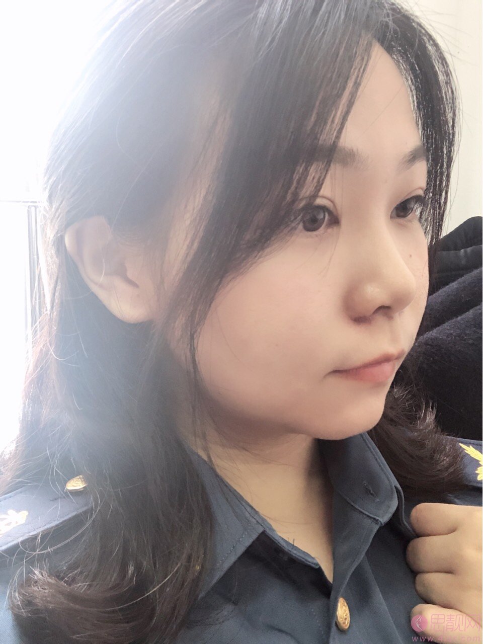 浙江大学医学院附属第二医院整形科怎么样?2020价格表一览+鼻翼缩小案例