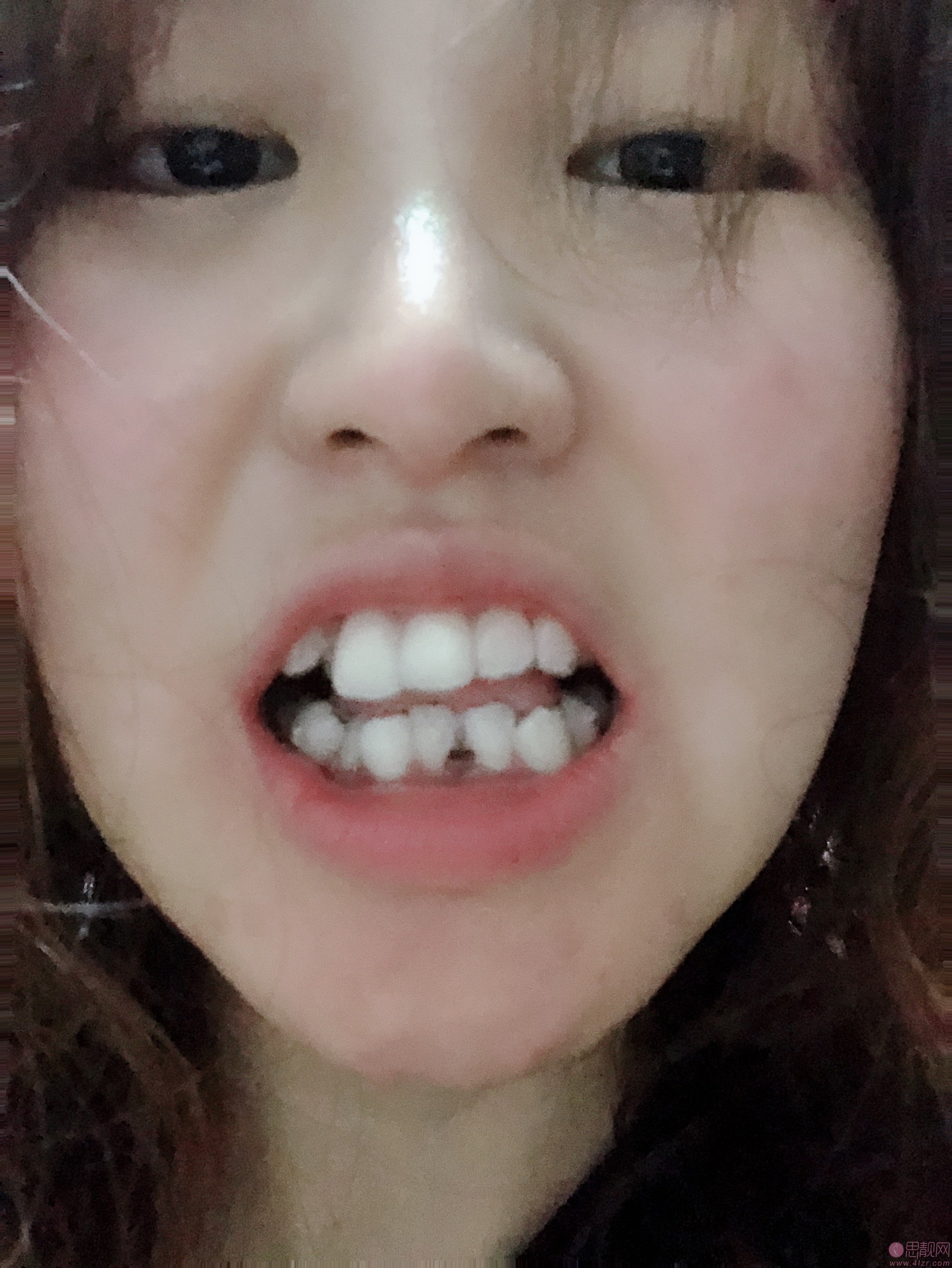 上海薇琳美学齿科牙齿矫正怎么样?价格表一览2020最新出炉