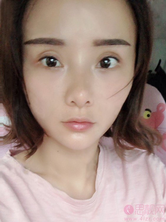 重庆曹阳丽格医疗美容医院曹阳做眼修复怎么样？2020价格表曝光