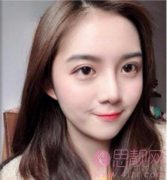 硅胶隆鼻后遗症一般多久发现