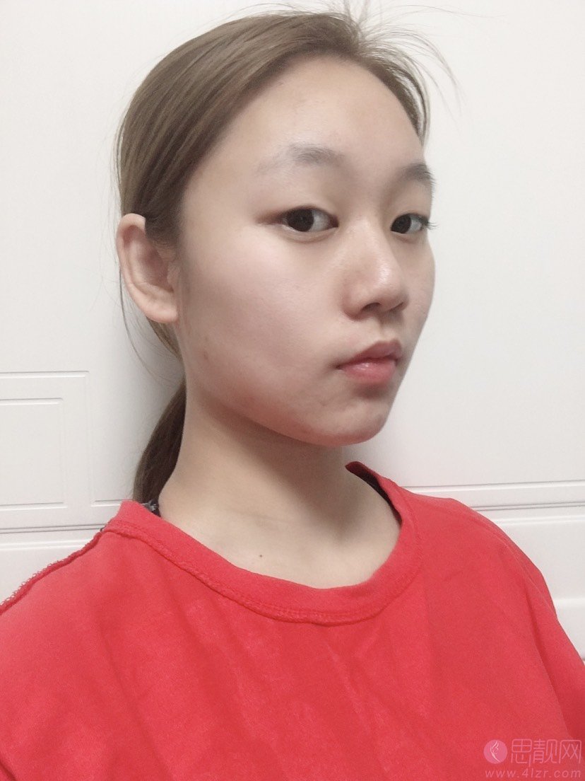 上海欧莱美医疗美容医院李强做双眼皮怎么样？2020价格表一览
