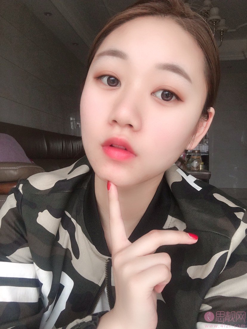 上海欧莱美医疗美容医院李强做双眼皮怎么样？2020价格表一览