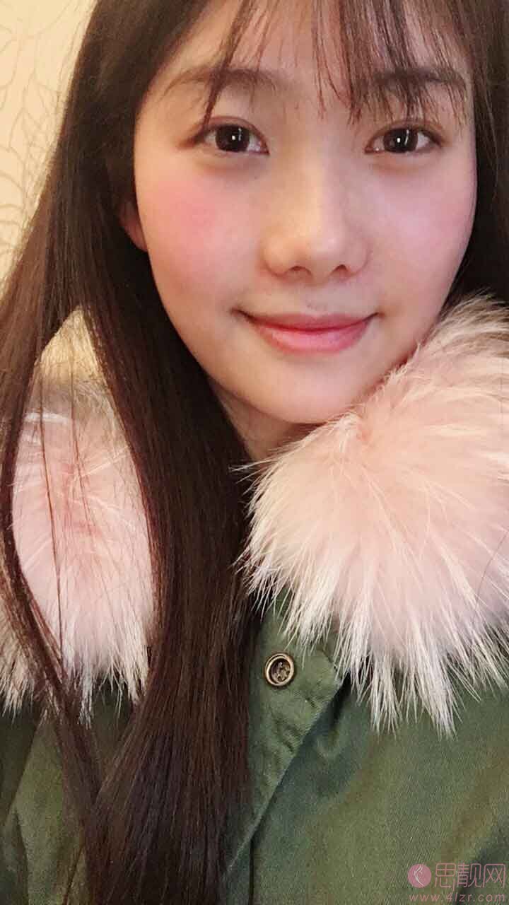 武汉一美医疗美容李兰华隆鼻怎么样?2020价格表一览