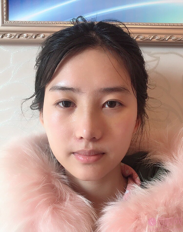 武汉一美医疗美容李兰华隆鼻怎么样?2020价格表一览