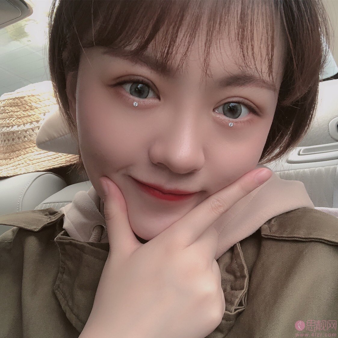 天津菲丝澜医疗美容党涛做双眼皮怎么样?2020价格表一览