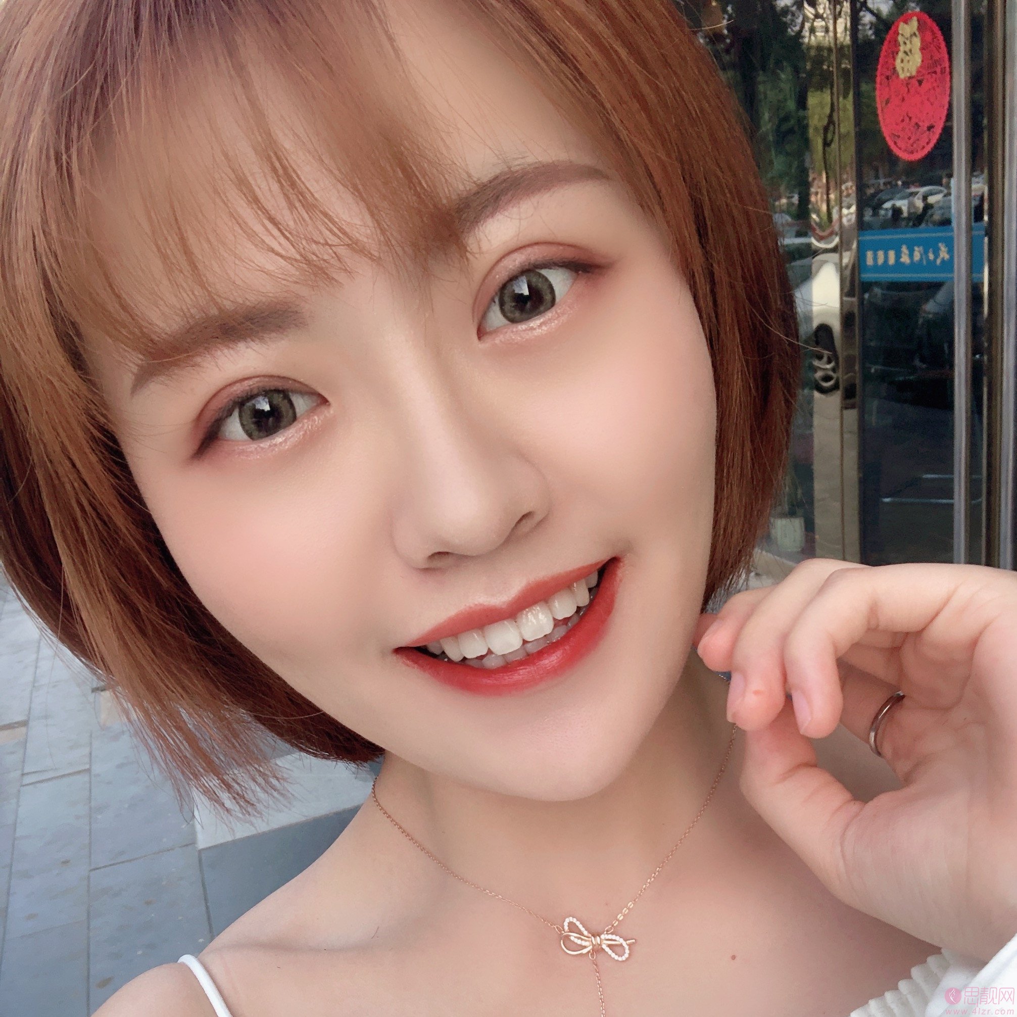 天津菲丝澜医疗美容党涛做双眼皮怎么样?2020价格表一览