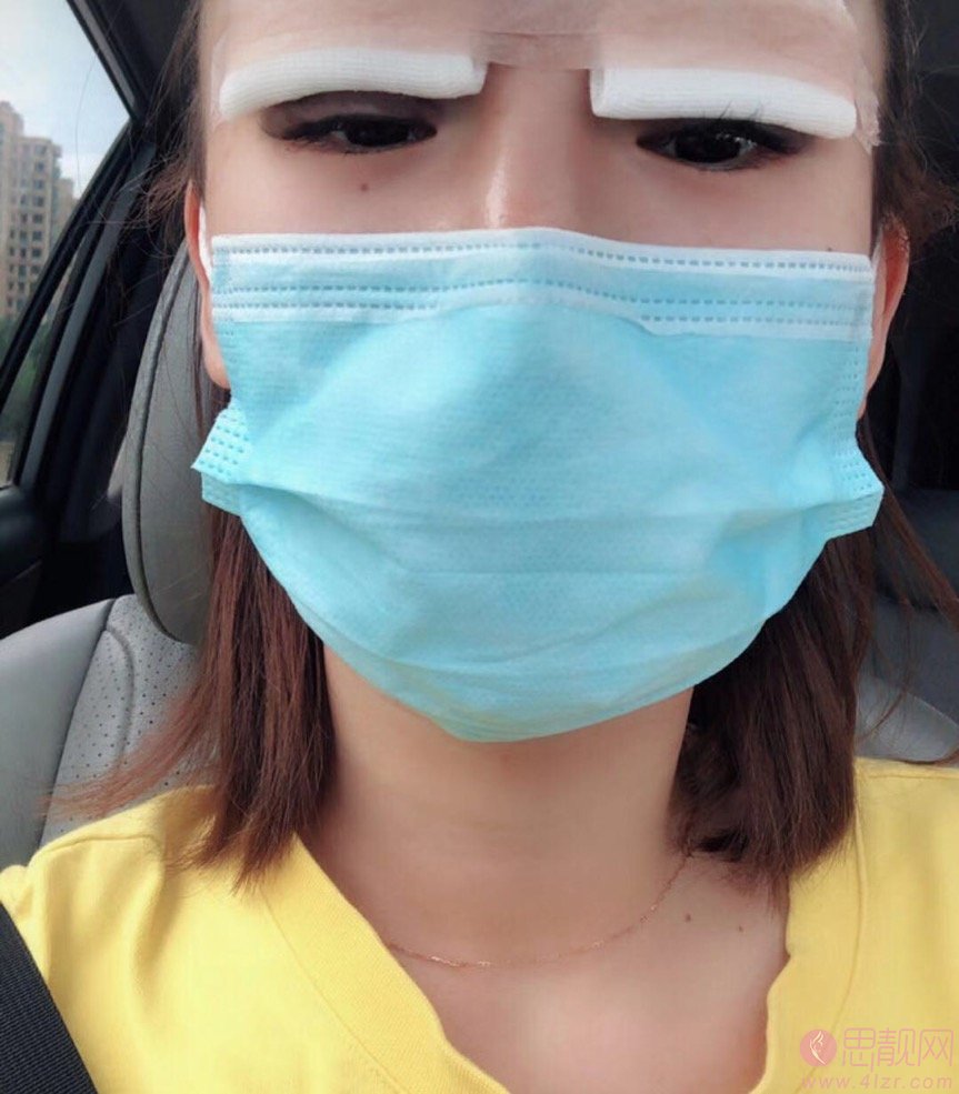武汉华美整形外科总院（中整协修复基地）付马行做双眼皮怎么样？2020价格表一览