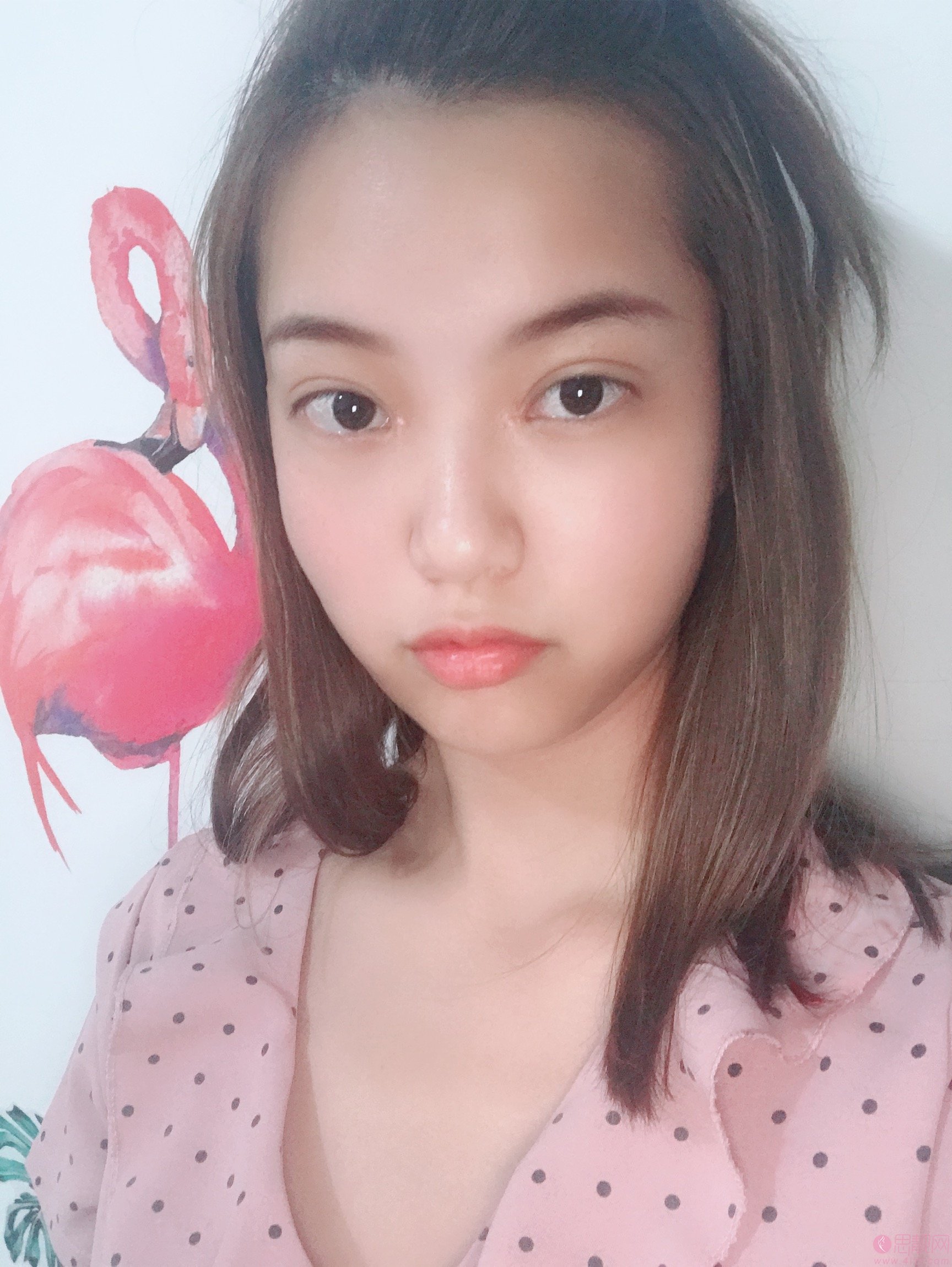 武汉华美整形外科总院（中整协修复基地）付马行做双眼皮怎么样？2020价格表一览
