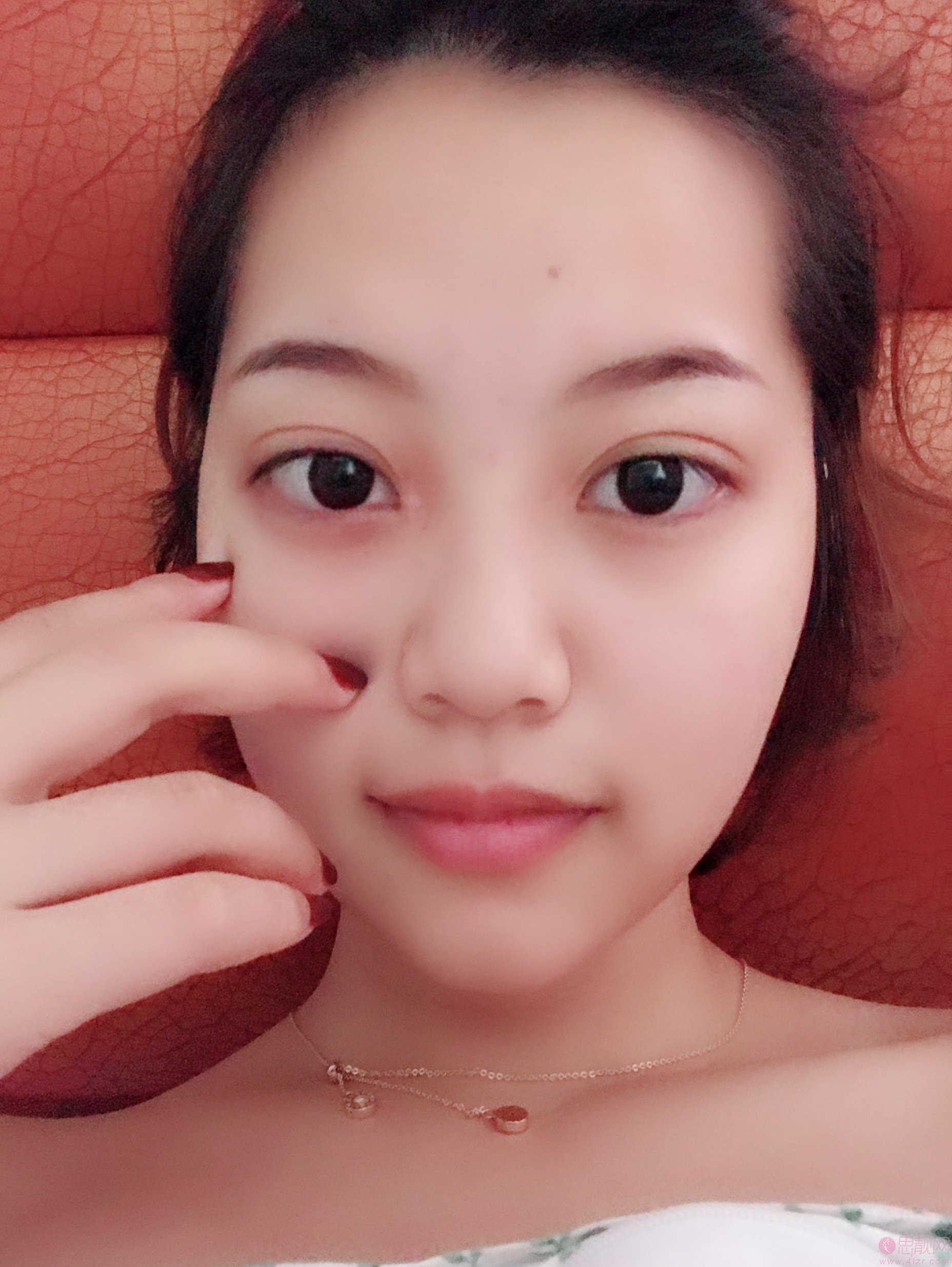 武汉华美整形外科总院（中整协修复基地）付马行做双眼皮怎么样？2020价格表一览