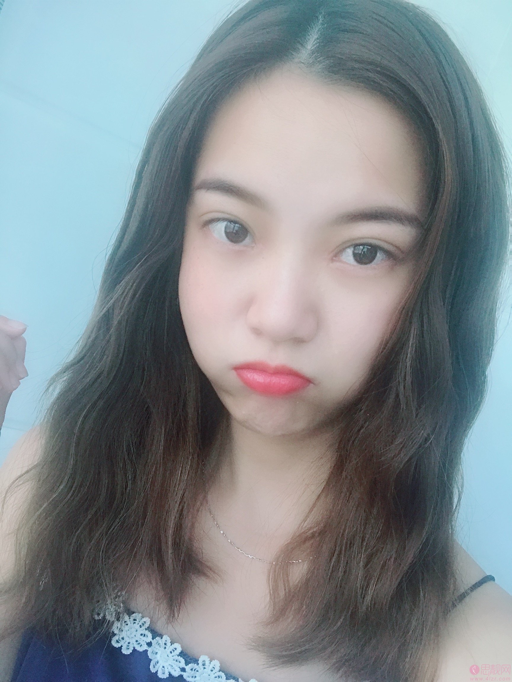 武汉华美整形外科总院（中整协修复基地）付马行做双眼皮怎么样？2020价格表一览