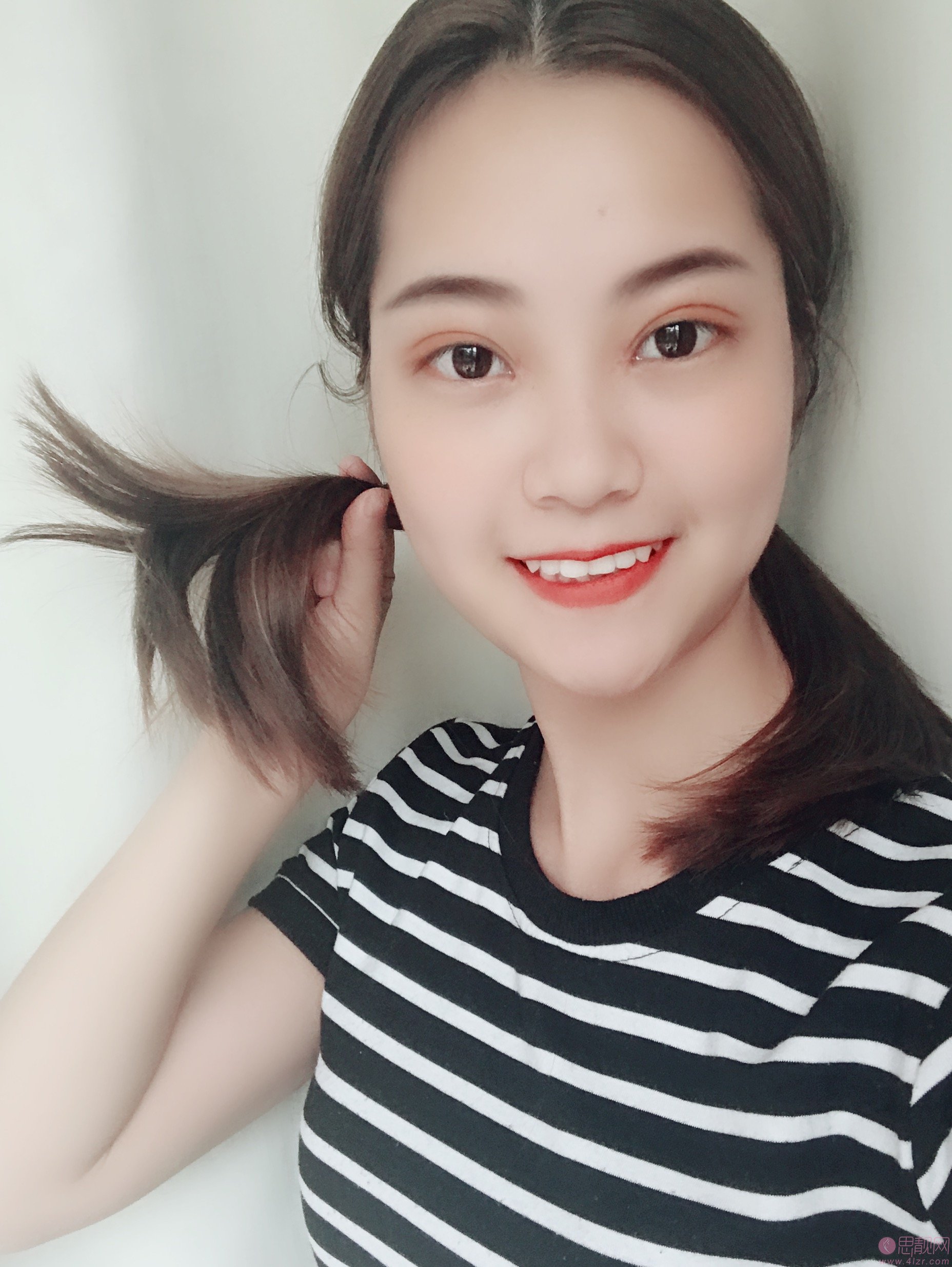 武汉华美整形外科总院（中整协修复基地）付马行做双眼皮怎么样？2020价格表一览