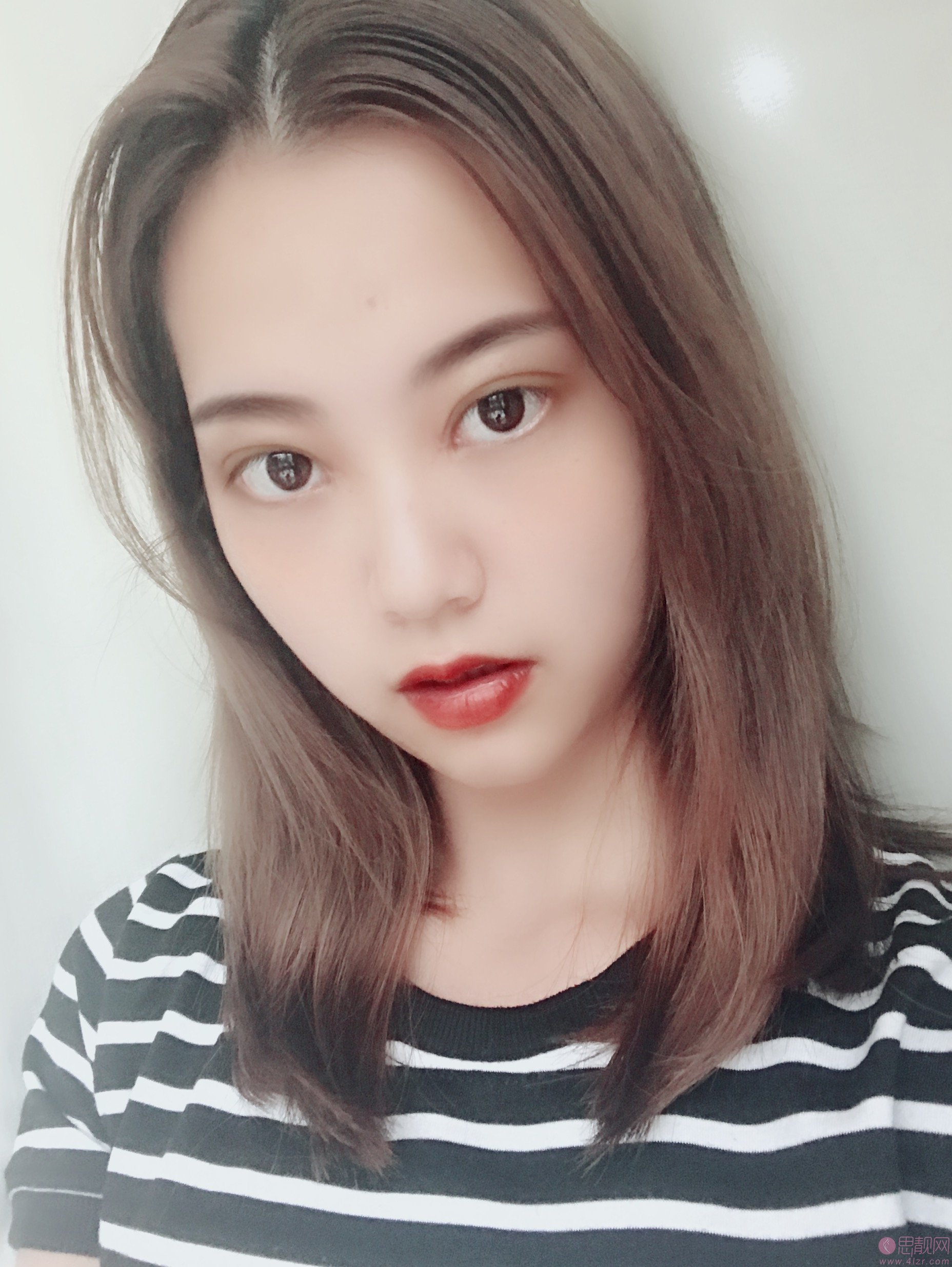 武汉华美整形外科总院（中整协修复基地）付马行做双眼皮怎么样？2020价格表一览