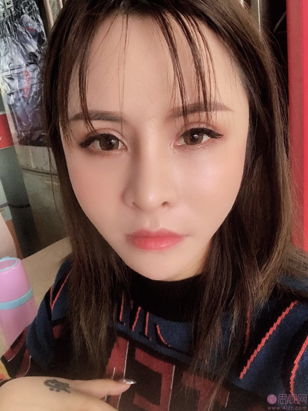 广州艺美医疗美容门诊部李闯隆鼻怎么样？2020价格表一览+隆鼻案例欣赏
