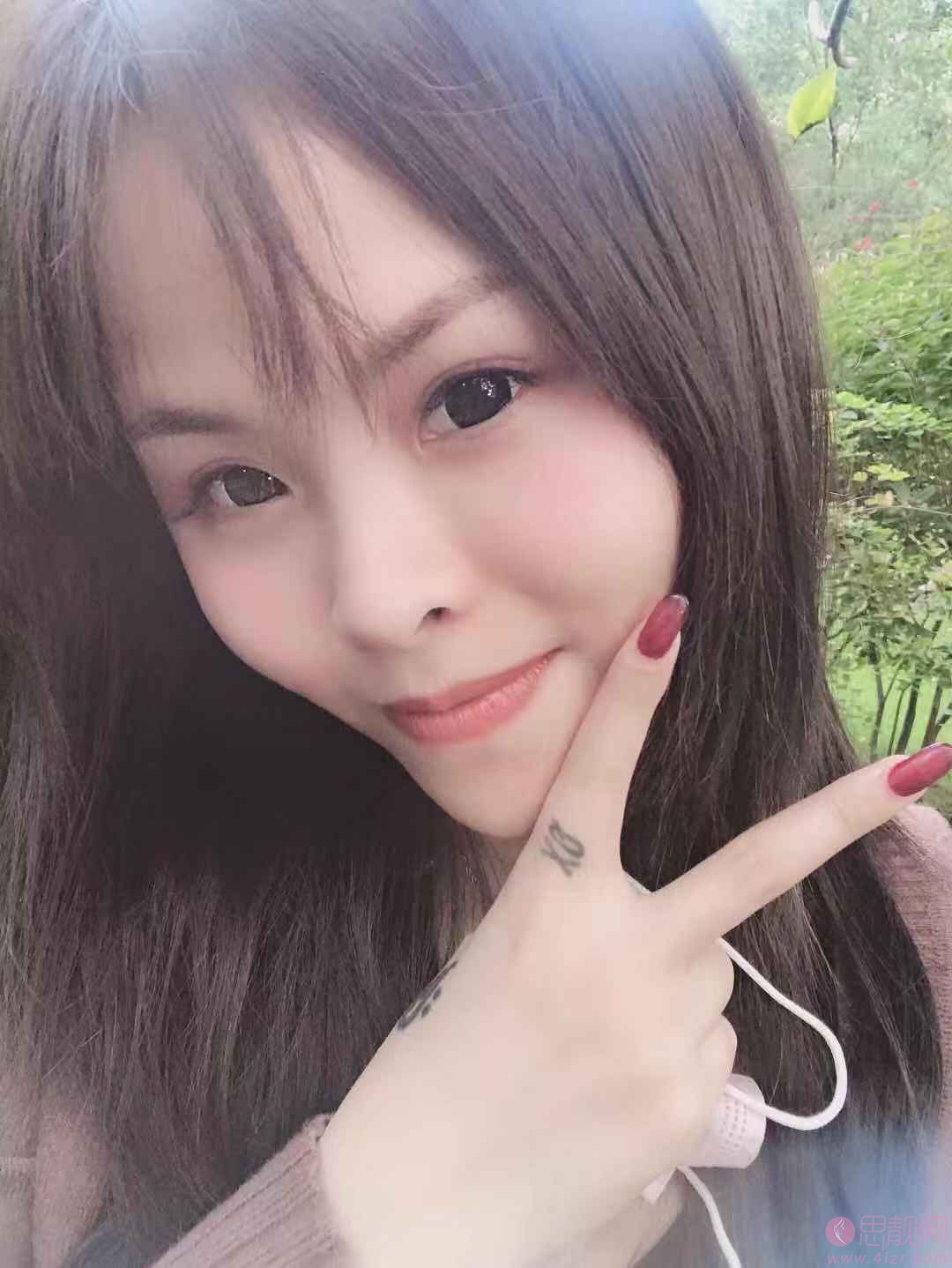 广州艺美医疗美容门诊部李闯隆鼻怎么样？2020价格表一览+隆鼻案例欣赏
