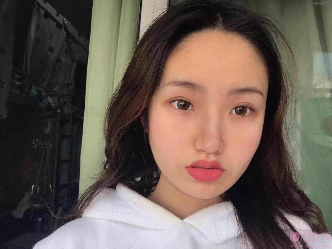 成都医大医院整形美容科2020价格表一览+李辉M唇手术案例