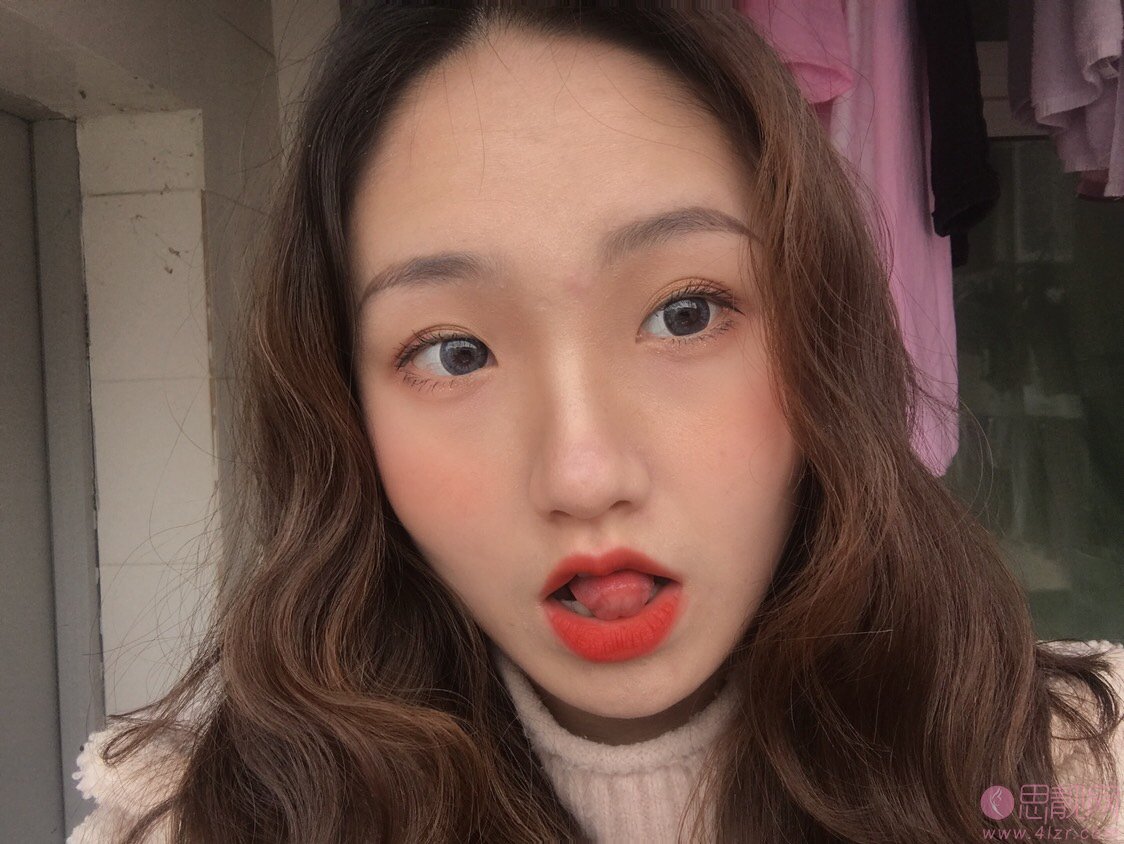 成都医大医院整形美容科2020价格表一览+李辉M唇手术案例