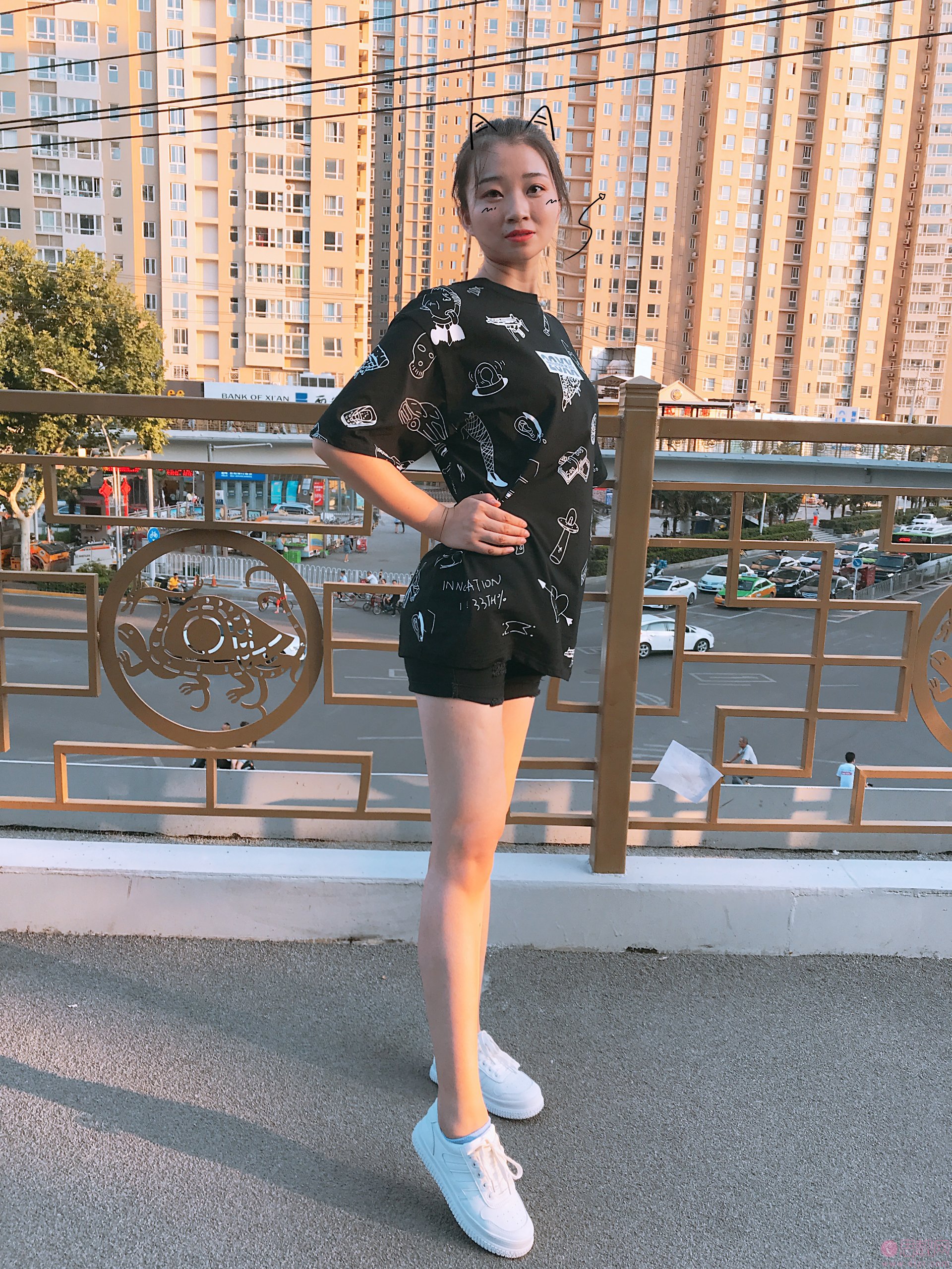西安美莱王鹏做大腿吸脂怎么样？2020价格表一览