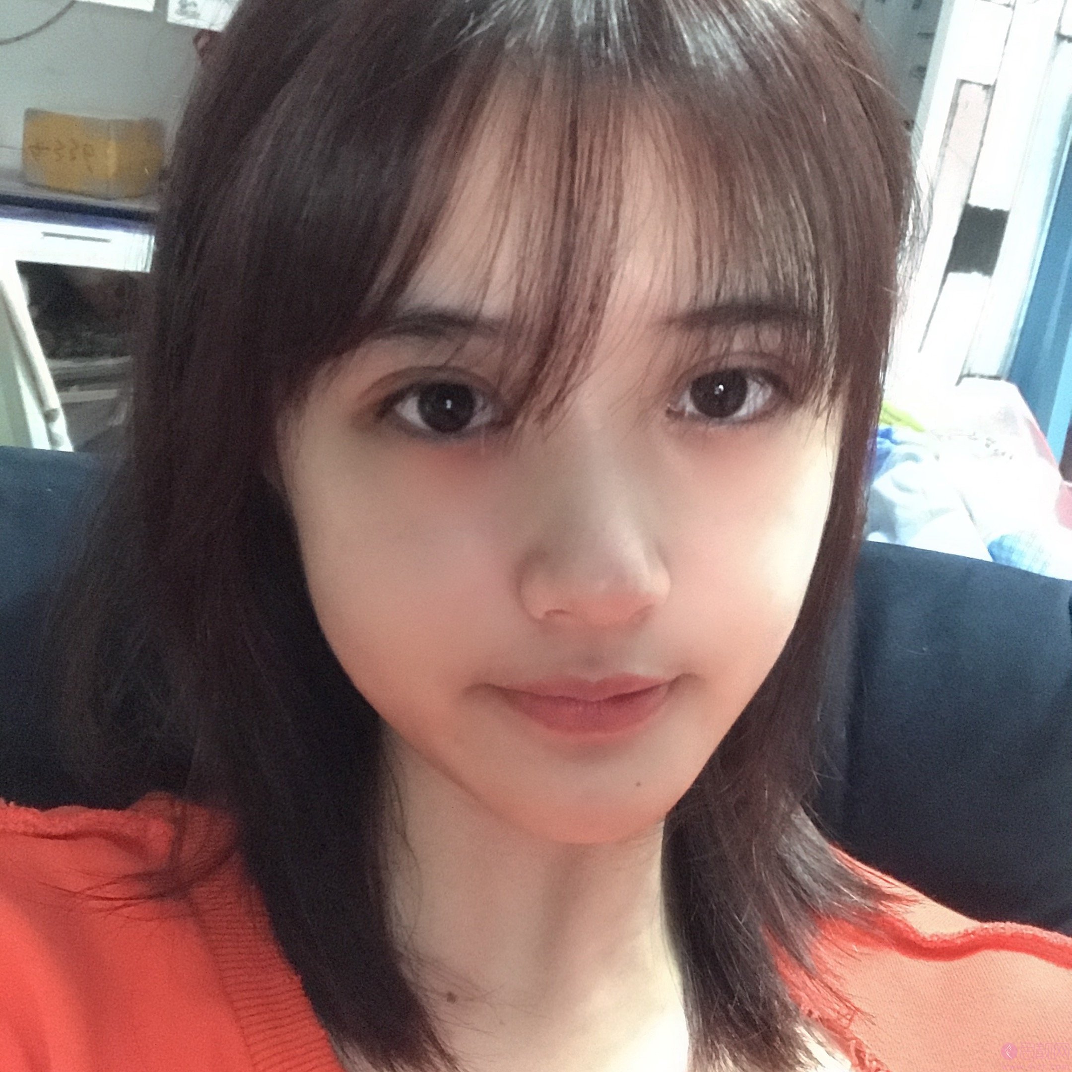 太原美诗沁医疗美容李东旭做双眼皮怎么样？2020价格表一览