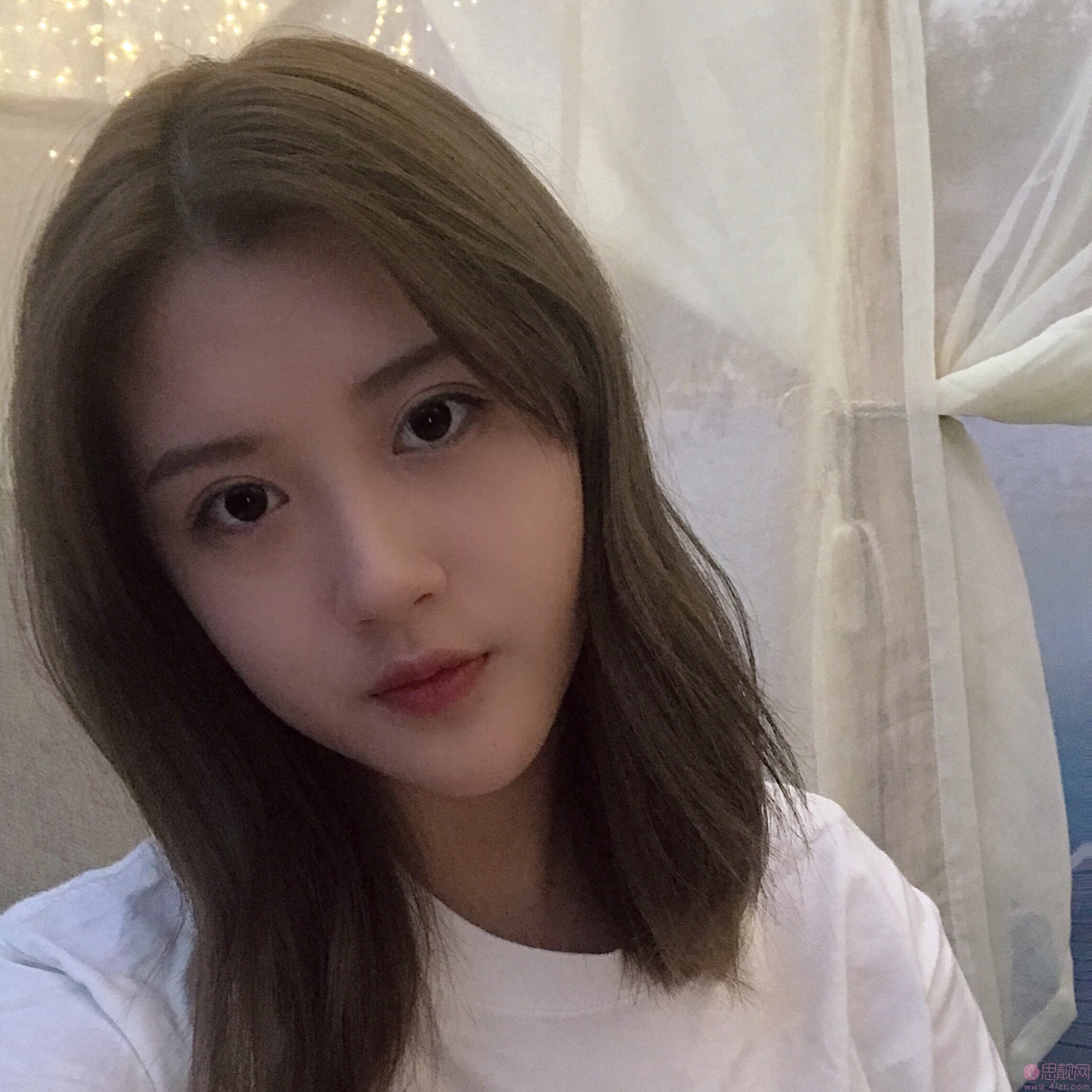 太原美诗沁医疗美容李东旭做双眼皮怎么样？2020价格表一览