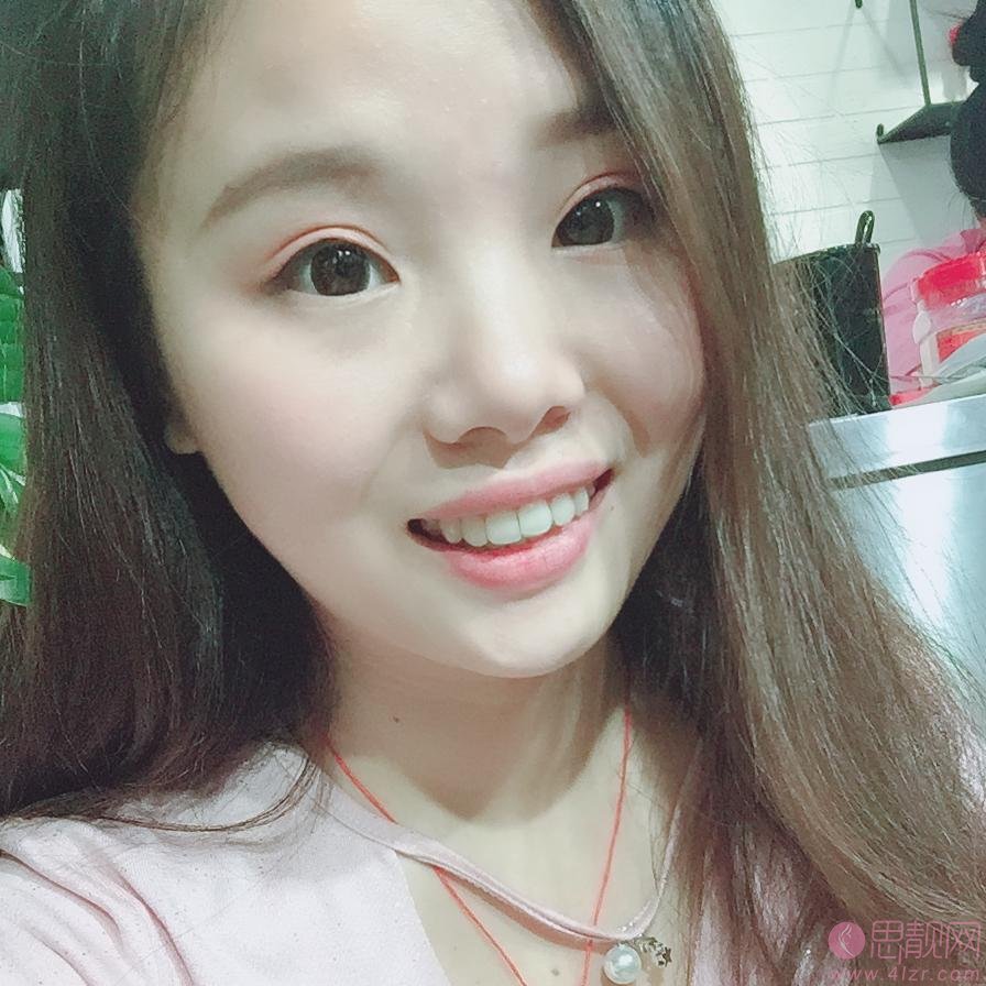 南京雅康口腔连锁(鼓楼院)李群医生怎么样？附牙齿矫正案例及2020最新价格表一览