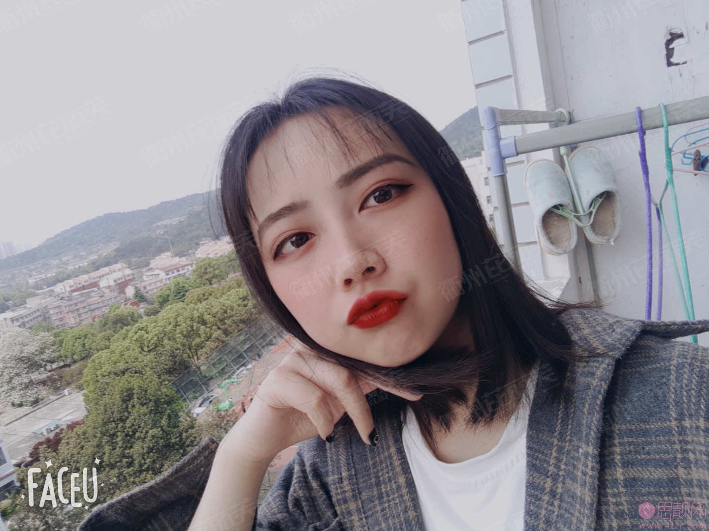 衢州芘丽芙美容医院做双眼皮怎么样?2020价格表一览+双眼皮案例分享