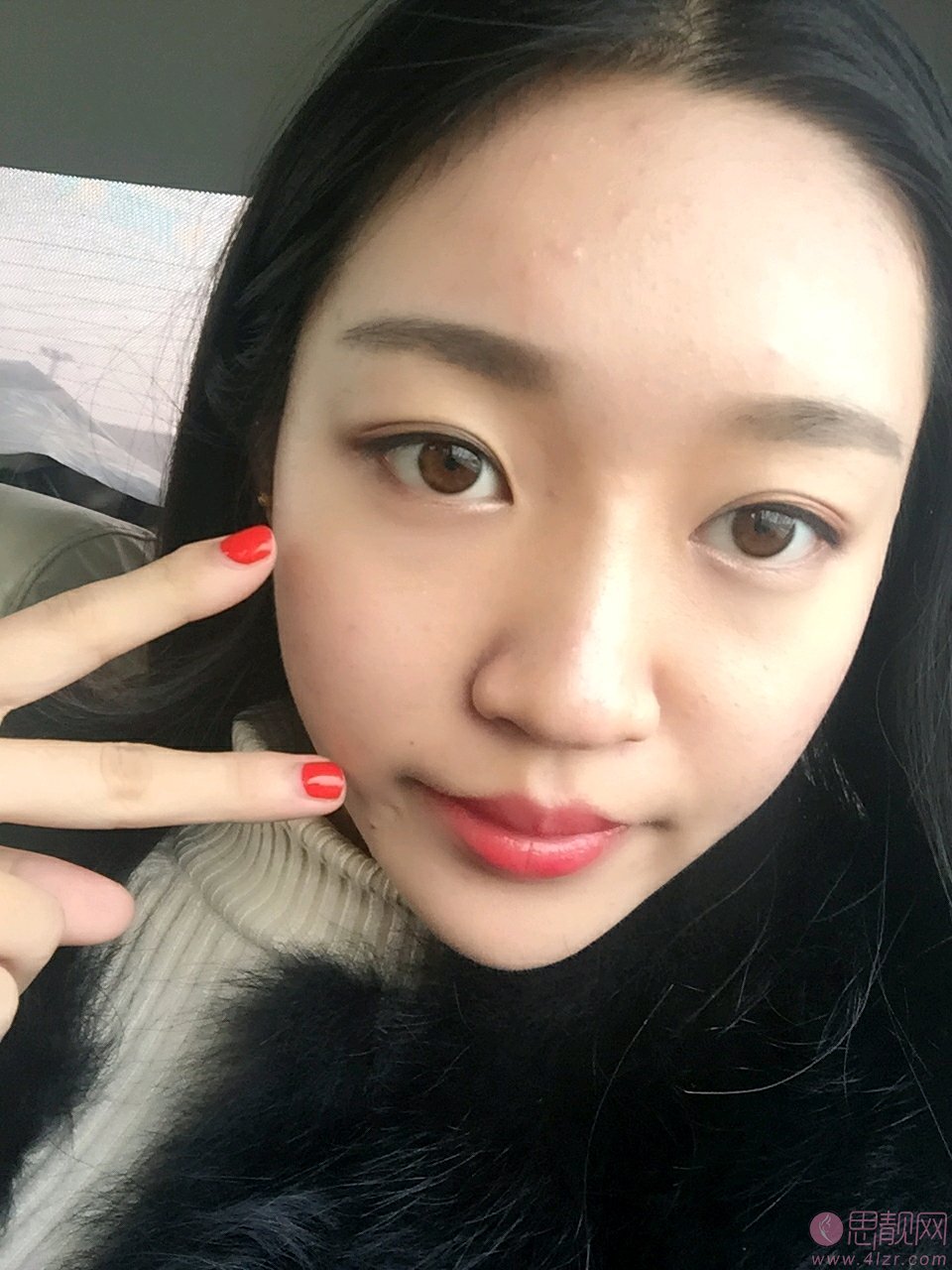 成都大华韩艺整形美容医院李猛隆鼻怎么样？2020价格表一览