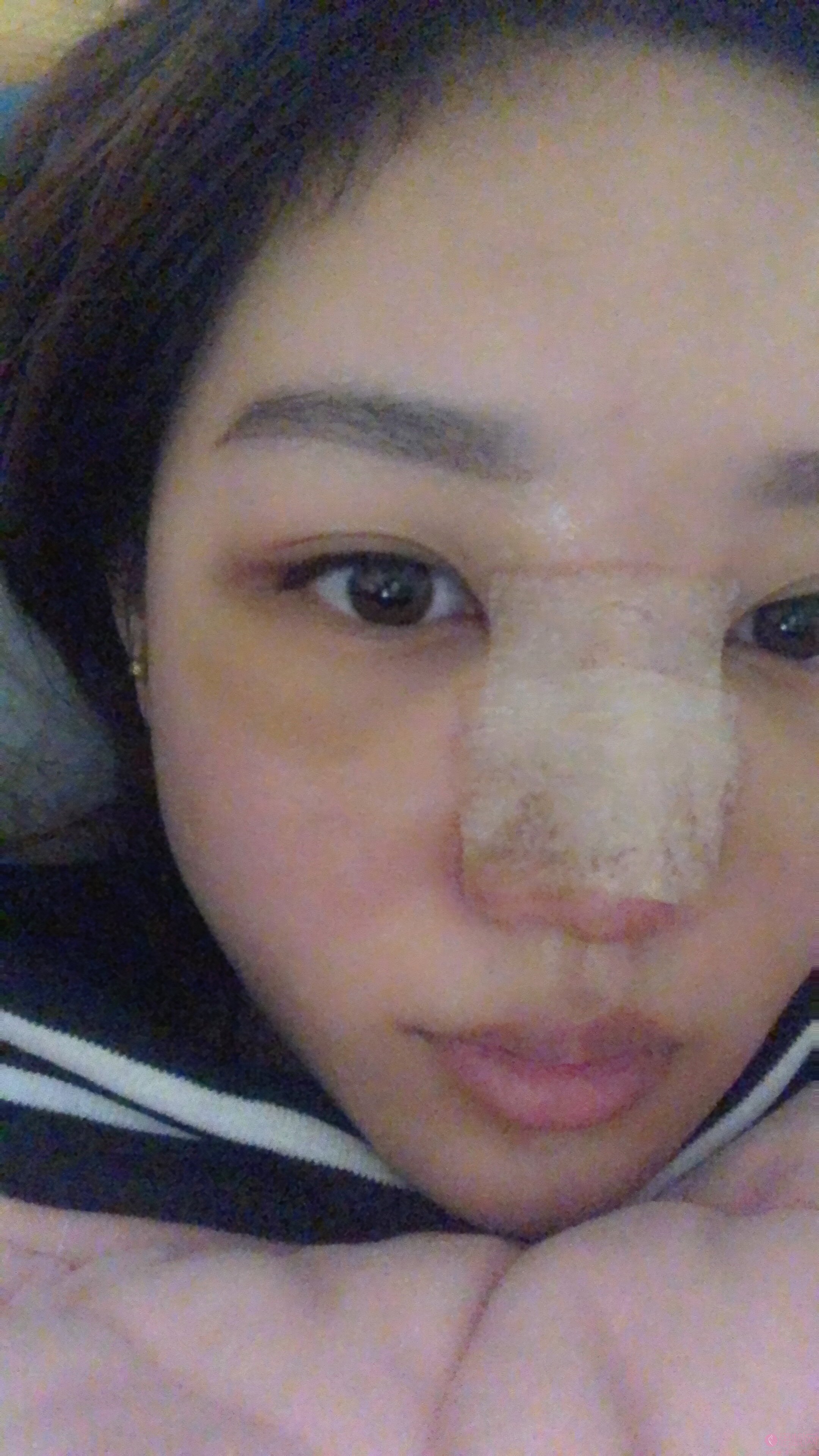 成都大华韩艺整形美容医院李猛隆鼻怎么样？2020价格表一览
