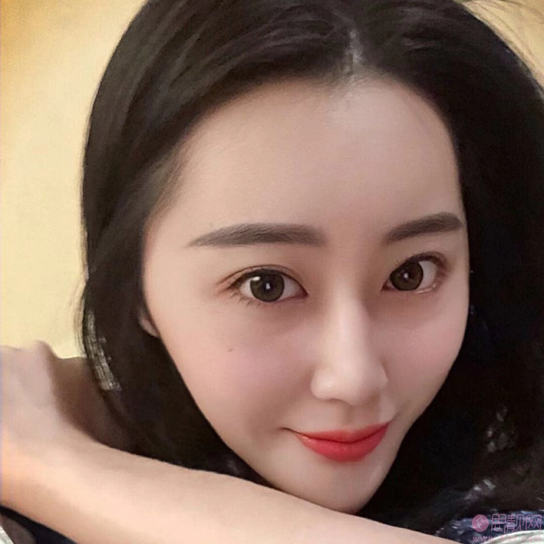 成都高新莱尹臻颜医疗美容门诊部刘辅容做眼修复怎么样？附修复前后对比效果及2020价格表一览