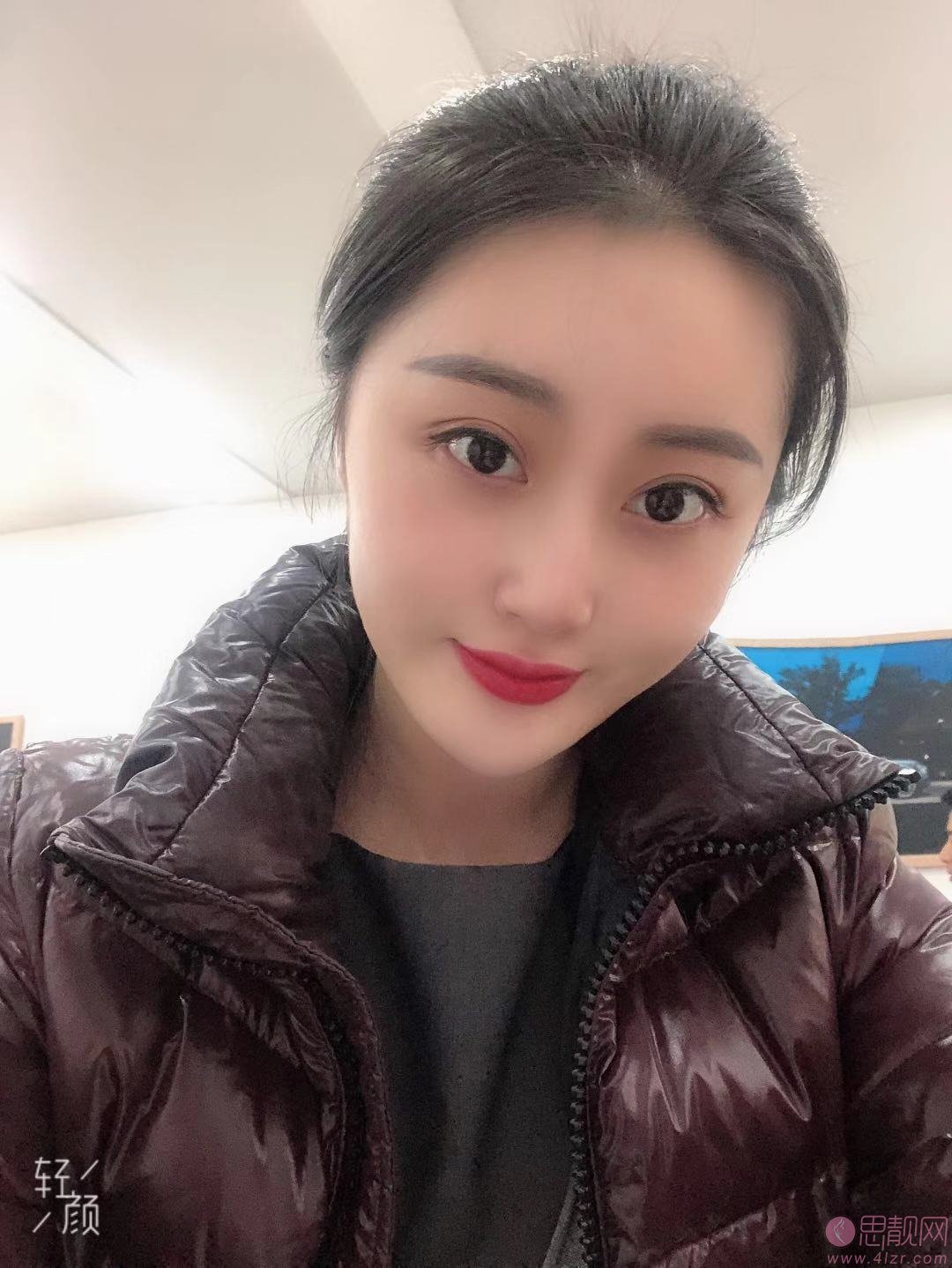 成都高新莱尹臻颜医疗美容门诊部刘辅容做眼修复怎么样？附修复前后对比效果及2020价格表一览