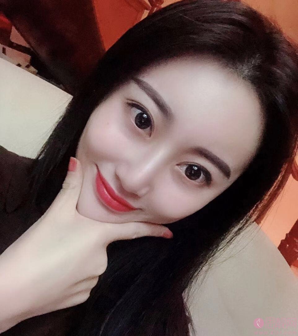 成都高新莱尹臻颜医疗美容门诊部刘辅容做眼修复怎么样？附修复前后对比效果及2020价格表一览