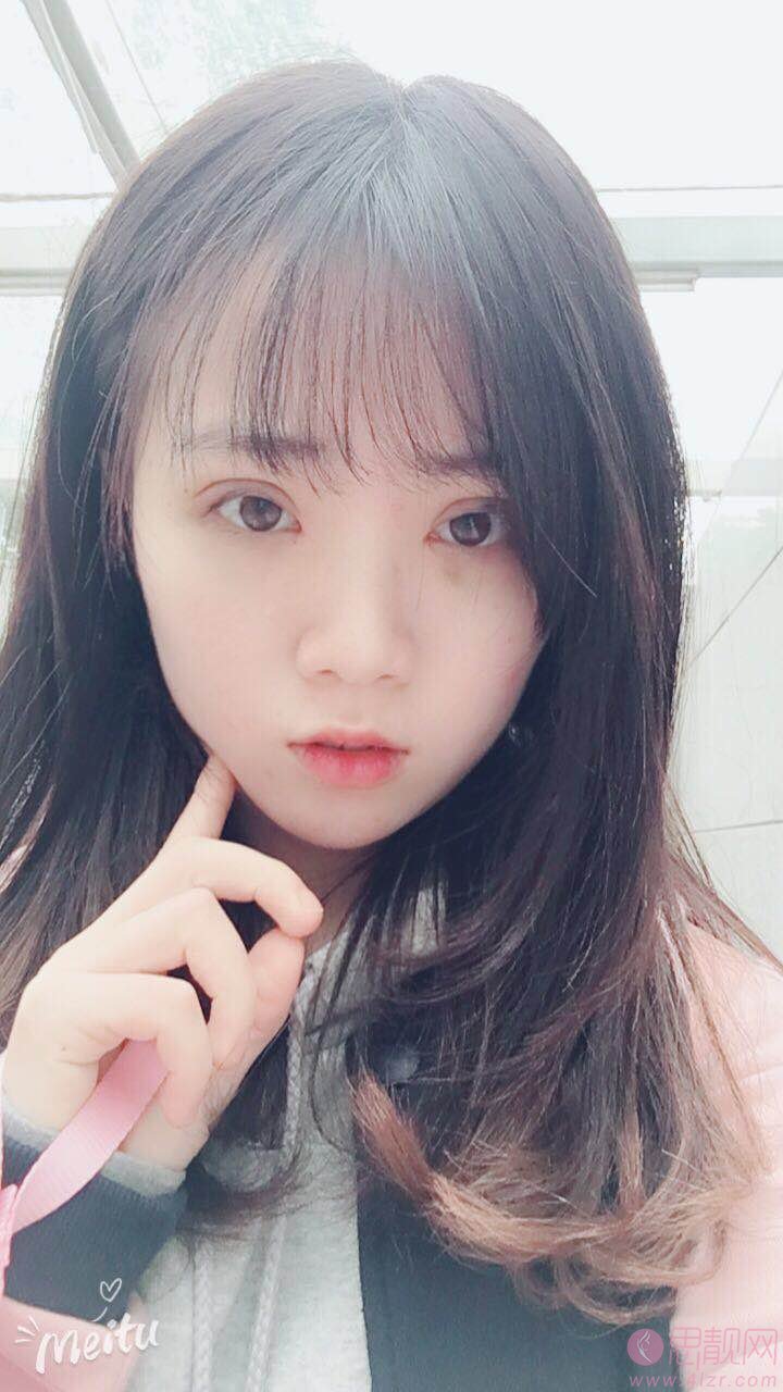 成都美极医疗美容隆鼻怎么样？附隆鼻前后对比及2020价格表一览