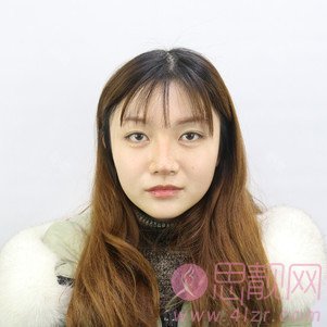 成都美容整形医院（成美）冯春雨隆鼻怎么样？2020价格表一览
