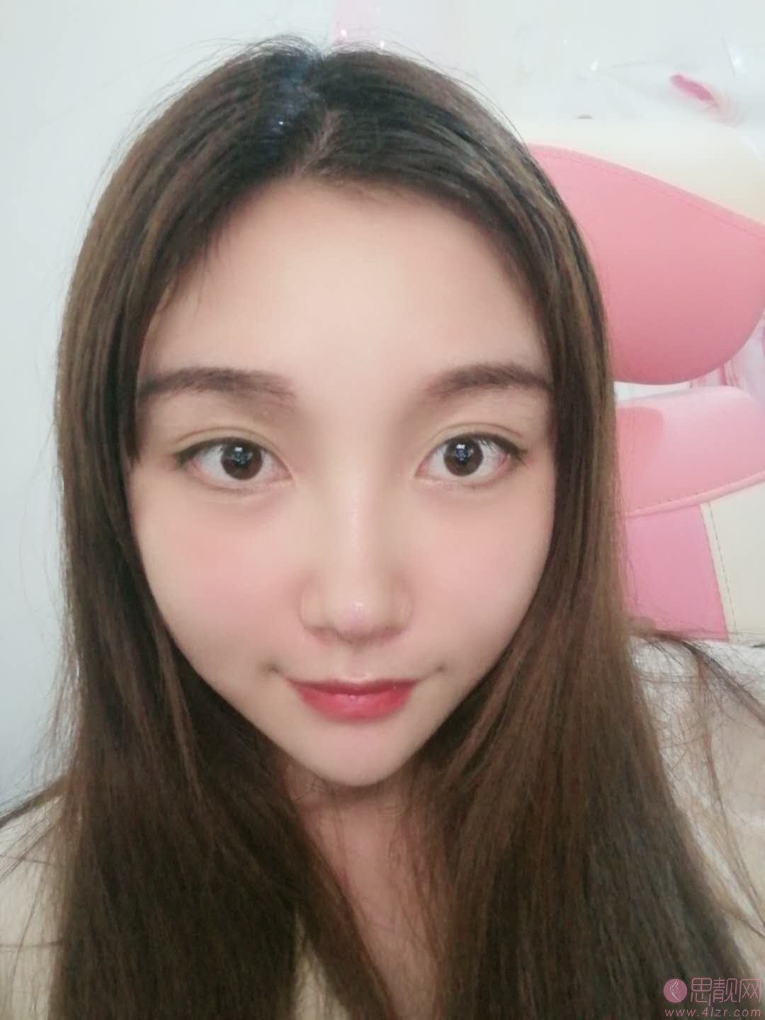 成都美容整形医院（成美）冯春雨隆鼻怎么样？2020价格表一览